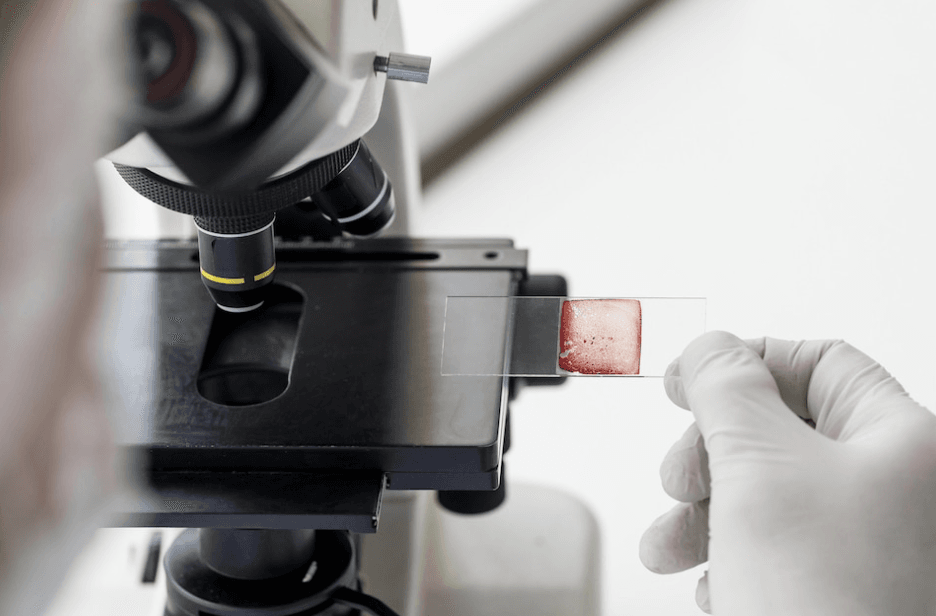 Home 8 biopsia testicular